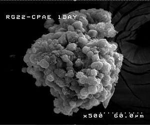 Researchers make living model of brain tumor