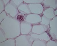 University Of Pittsburgh Researchers Culture Blood-Forming Stem Cells From Human Fat Tissue