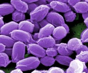 Simple, fast anthrax detector described