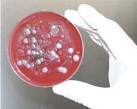Early Detection And Quick Response Keys To Defense Against Anthrax Attack