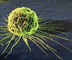 Blocking Rogue Gene Could Stop The Spread Of Most Cancers