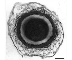 Mining the botulinum genome