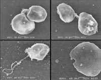 Bacterium Could Treat PCBs Without The Need For Dredging