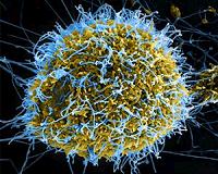 New study highlights effectiveness of a herpesvirus CMV-based vaccine against Ebola
