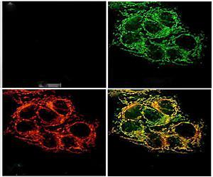 New sensor tracks zinc in cells