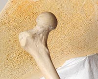 Station Astronauts Lose Alarming Amounts Of Hipbone Strength