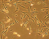 Reprogramming The Debate: Stem-Cell Finding Alters Ethical Controversy
