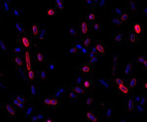 New one-step process for designer bacteria