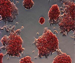 Making it easier to make stem cells