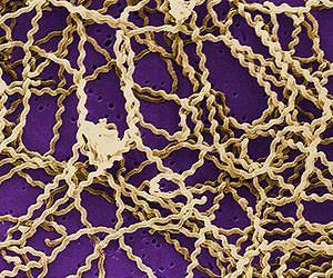 Widespread but neglected disease a health threat in Africa