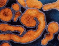 Botulism bacteria found in green beans