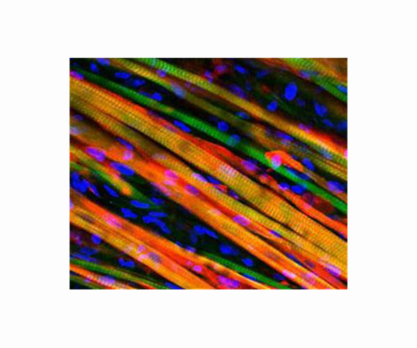Muscle tissue from a 3D printer - produced in zero gravity
