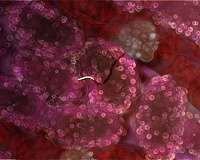 New portable malaria screening instrument developed