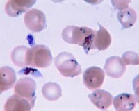 New method for producing malaria treatment at large scales