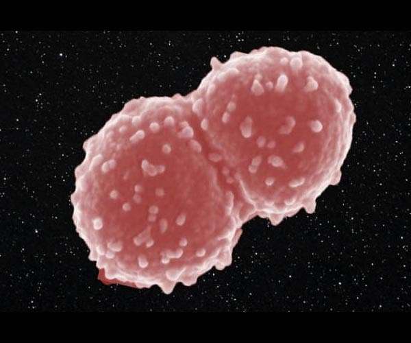 How Deinococcus Radiodurans thrives in extreme radiation