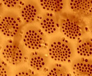 Microbial World's Use Of Metals Mostly Unmapped