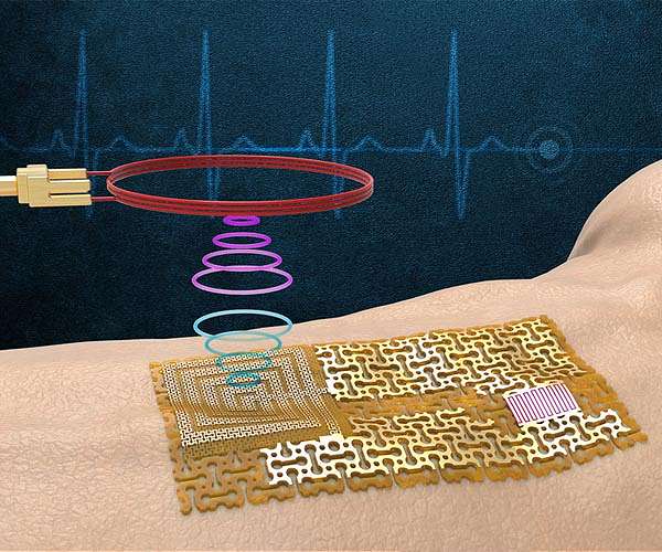 Engineers fabricate a chip-free, wireless electronic skin