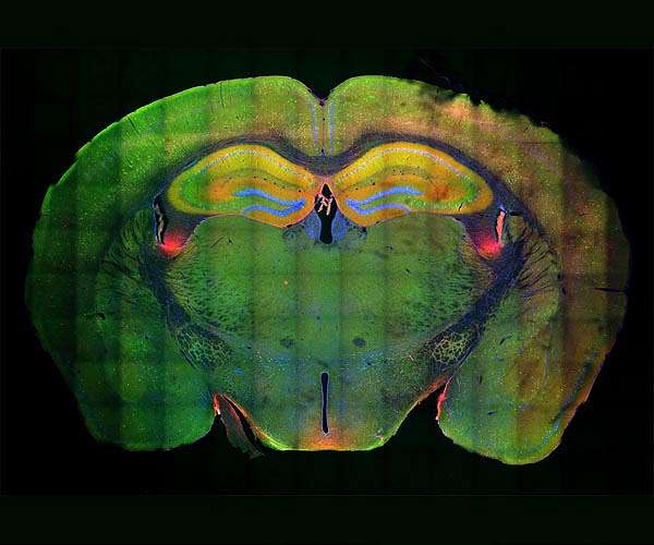 Study: Injured brain's ability to heal may hinge on time of day, circadian rhythms