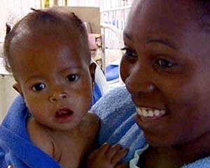 AIDS at 30: New funds, smarter spending needed - UNAIDS