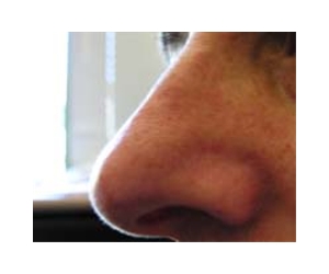 Sniffing Out The Evolution Of Chemical Nociception