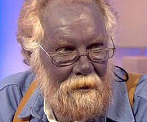 How silver turns people blue