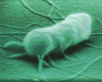 Spaceflight Shown To Alter Ability Of Bacteria To Cause Disease