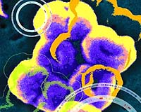 Genome Sequence Shows What Makes Bacteria Dangerous For Troops In Iraq
