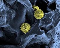 New material will allow abandoning bone marrow transplantation