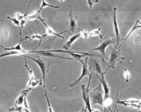 Cancerous stem cells researched