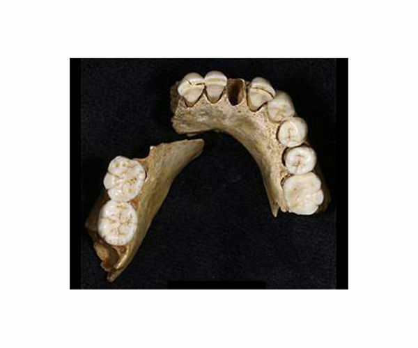 4,000-year-old teeth record the earliest traces of people chewing psychoactive betel nuts