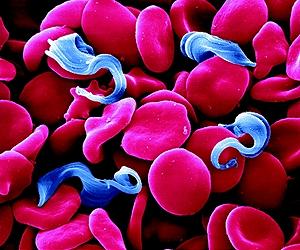 Safer Treatment Could Be Realized For Millions Suffering From Parasite Infection