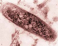 TB strains more drug-resistant, WHO says