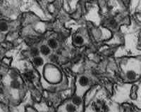 Zika epidemic should fizzle out within 3 yrs: study