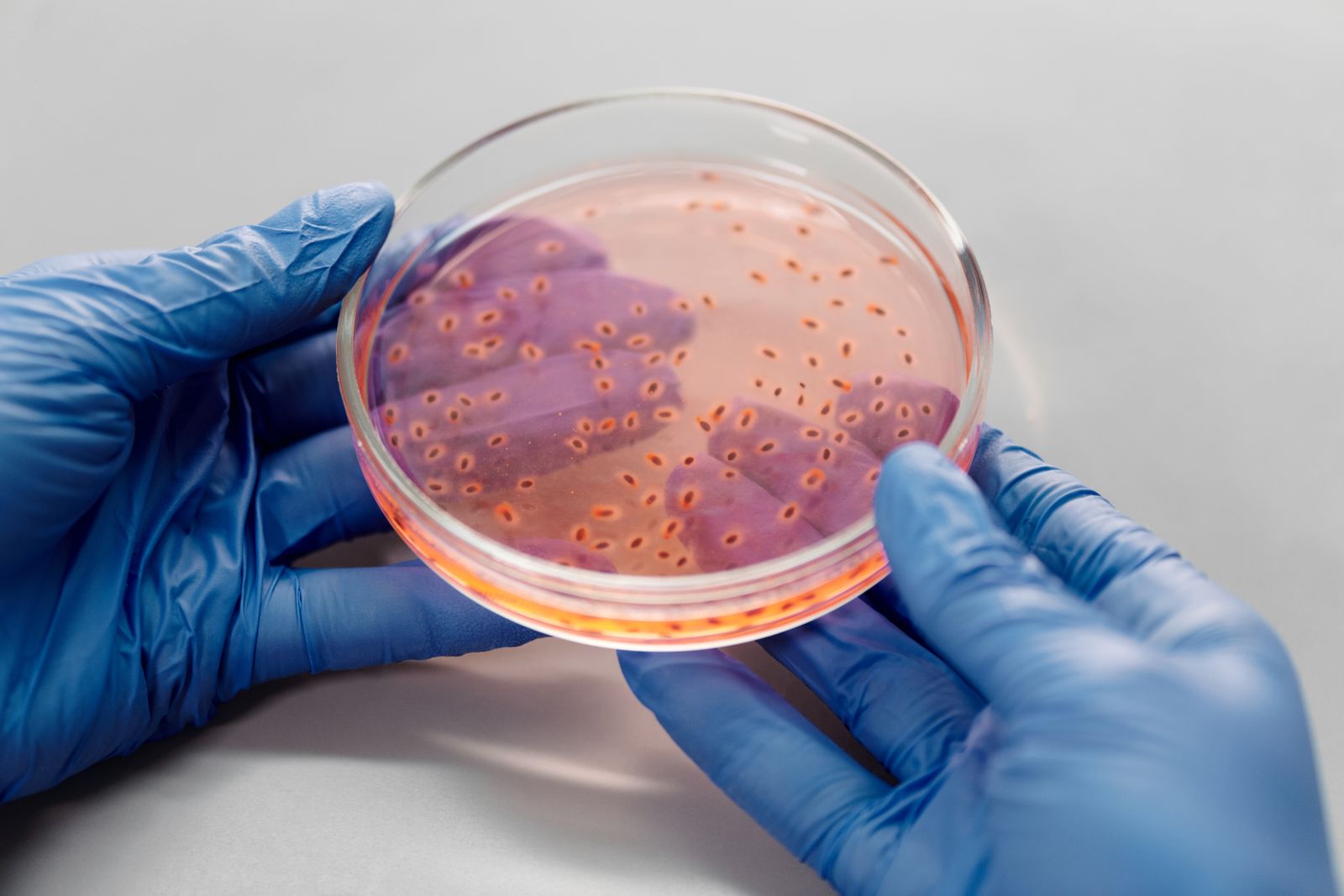 petri dish bacteria